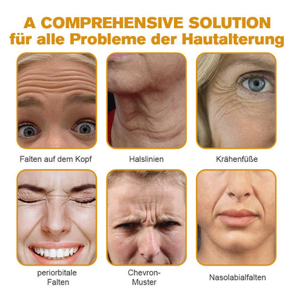 🔥🔥Letzter Tag der Aktion: 70 % Rabatt - ✨Furzero™ Botox Bienenvenom Faltenentfernungscreme
