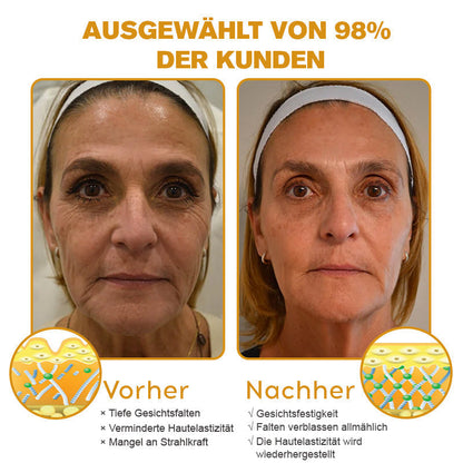 🔥🔥Letzter Tag der Aktion: 70 % Rabatt - ✨Furzero™ Botox Bienenvenom Faltenentfernungscreme