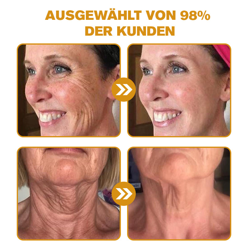 🔥🔥Letzter Tag der Aktion: 70 % Rabatt - ✨Furzero™ Botox Bienenvenom Faltenentfernungscreme