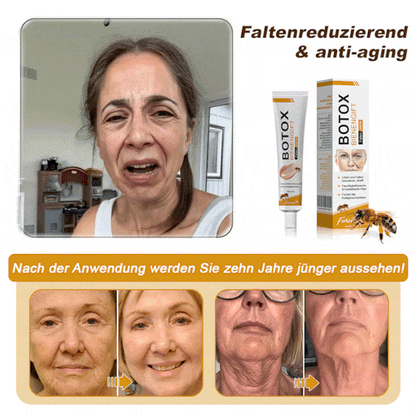 🔥🔥Letzter Tag der Aktion: 70 % Rabatt - ✨Furzero™ Botox Bienenvenom Faltenentfernungscreme